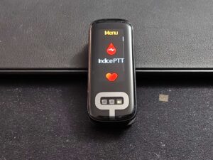 Recensione ASUS VivoWatch 6 Aero - Il Benessere al Polso 31 IMG20251116130718