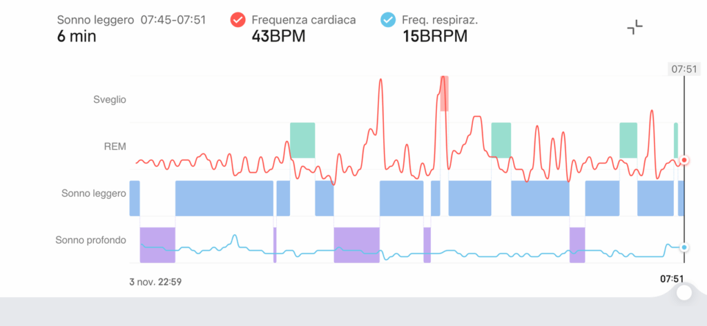 Dormiamo davvero così poco? Lo conferma lo Sleep Report 2025 firmato Amazfit 7 image003