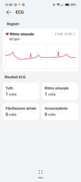 Recensione HUAWEI Watch D 81