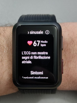 Recensione HUAWEI Watch D 83